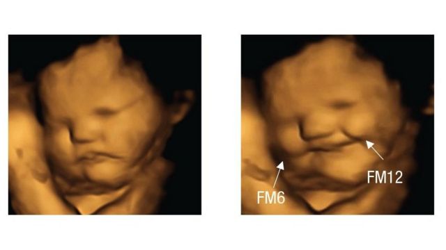 El estudio que mostró que los bebés en el vientre «sonríen» cuando sus mamás comen zanahorias y «fruncen el ceño» cuando comen col rizada